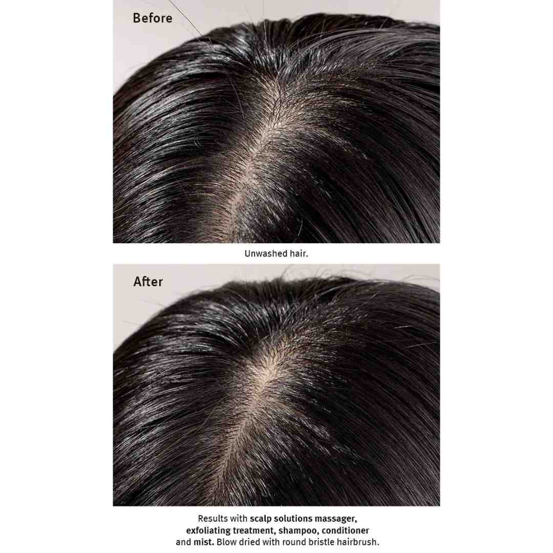 scalp solutions exfoliating treatment 12 | Charm and Champagne scalp solutions exfoliating treatment 12| Charm and Champagne