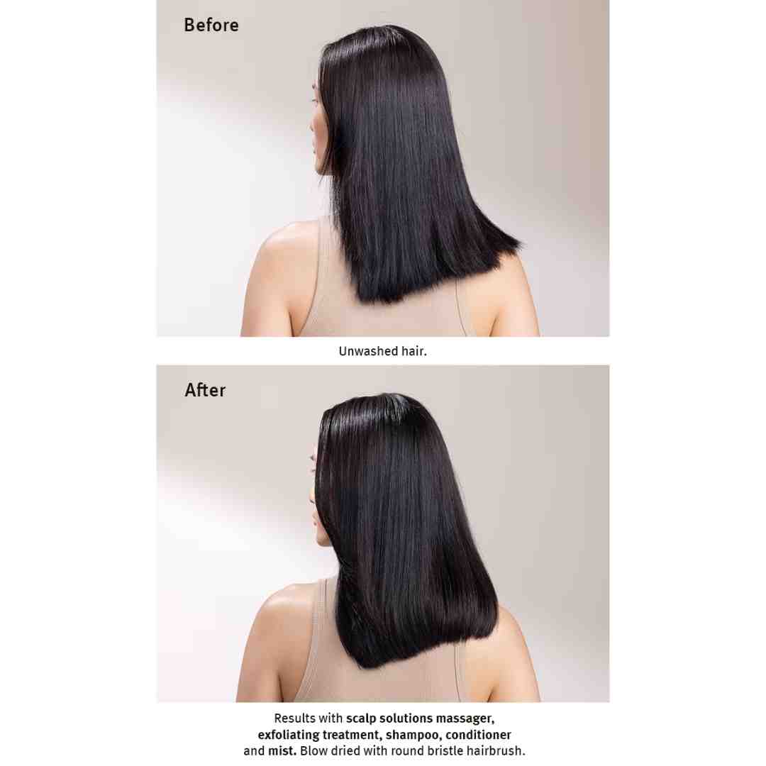 scalp solutions exfoliating treatment 15 | Charm and Champagne scalp solutions exfoliating treatment 15| Charm and Champagne