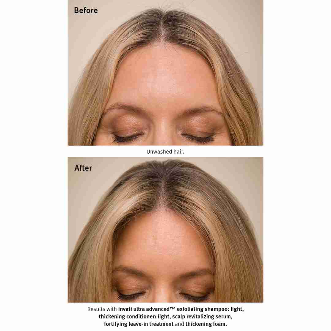 Invati Ultra Advanced™ Thickening Conditioner Light9 | Charm and Champagne Invati Ultra Advanced™ Thickening Conditioner Light9| Charm and Champagne