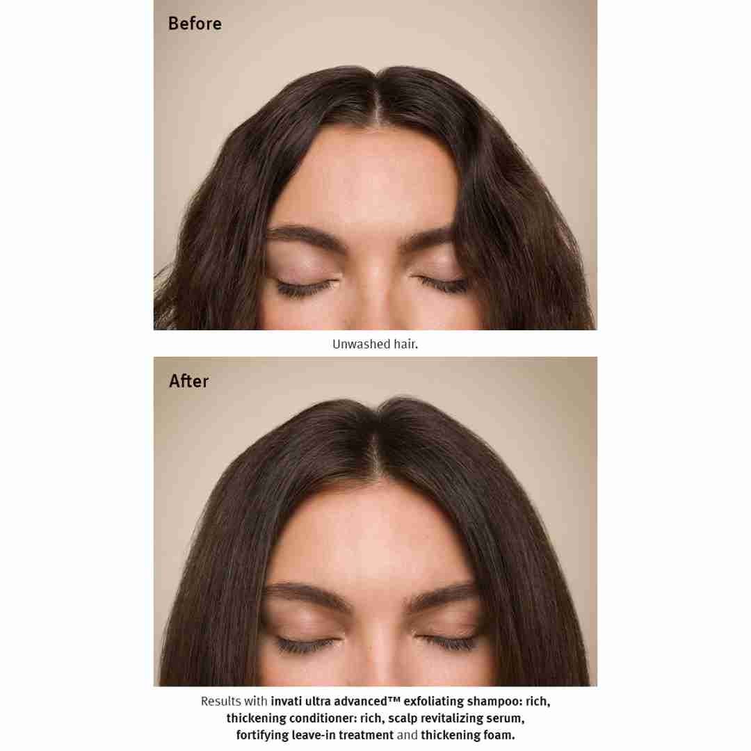 Invati Ultra Advanced™ Thickening Conditioner Rich6 | Charm and Champagne Invati Ultra Advanced™ Thickening Conditioner Rich6| Charm and Champagne