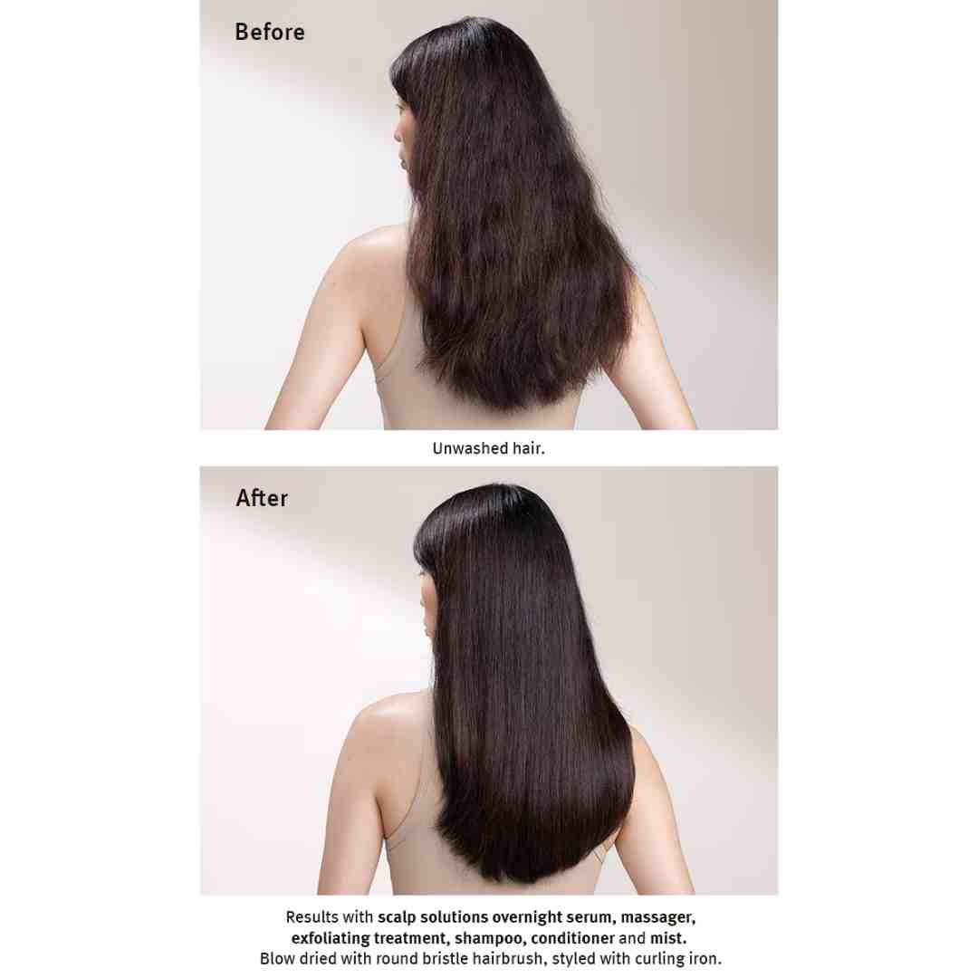 scalp solutions shampoo 1080 × 1080 px 3 | Charm and Champagne scalp solutions shampoo 1080 × 1080 px 3| Charm and Champagne