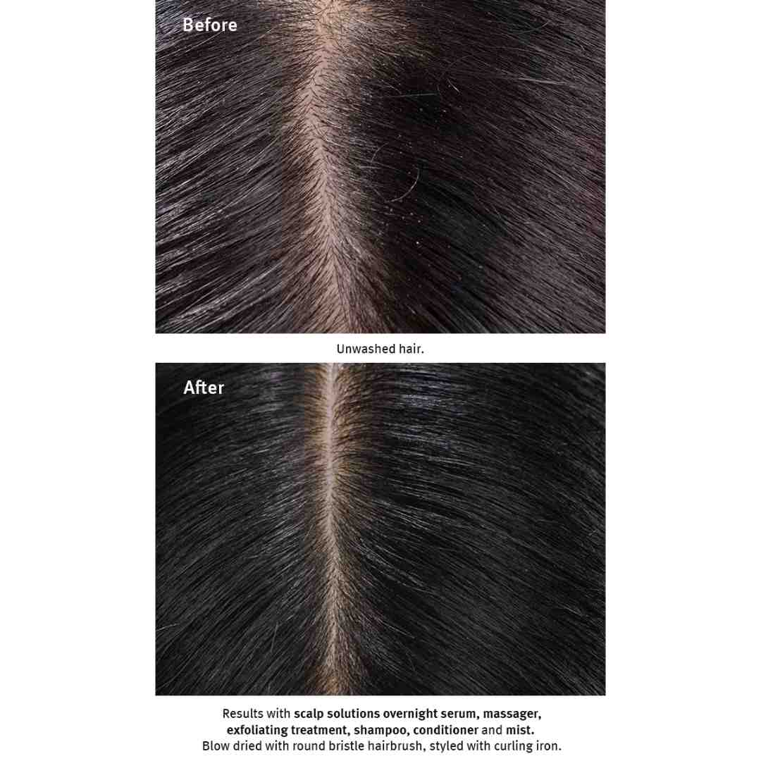 scalp solutions shampoo 1080 × 1080 px 4 | Charm and Champagne scalp solutions shampoo 1080 × 1080 px 4| Charm and Champagne